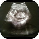 Full Term app for iPhone 7